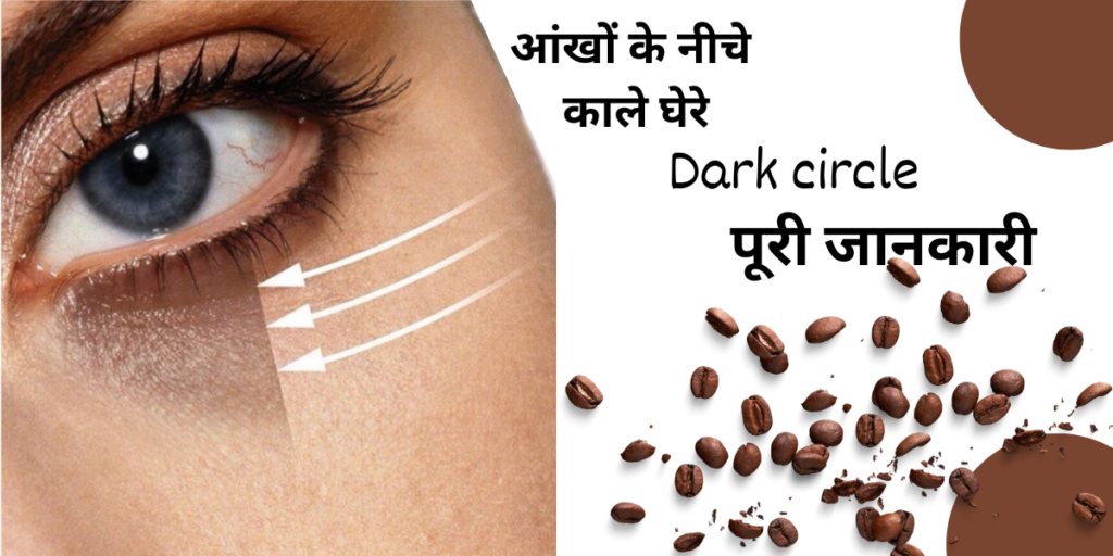 आंखों के नीचे काले घेरे Dark circle 